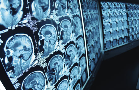 hearing loss ct scan